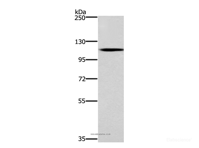 Western Blot analysis of Human fetal brain tissue using CARD14 Polyclonal Antibody at dilution of 1:650