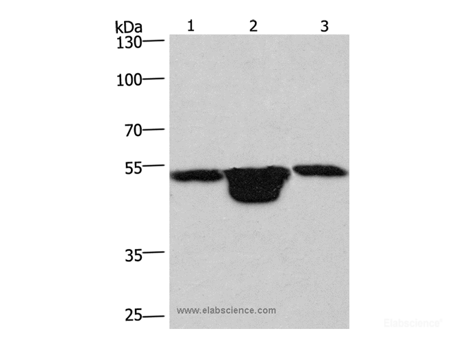Western Blot analysis of Hela cell, Mouse muscle and kidney tissue using PLEKHO1 Polyclonal Antibody at dilution of 1:200