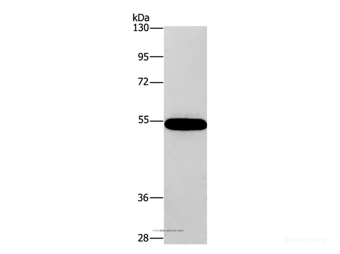 Western Blot analysis of 293T cell using CNDP1 Polyclonal Antibody at dilution of 1:320