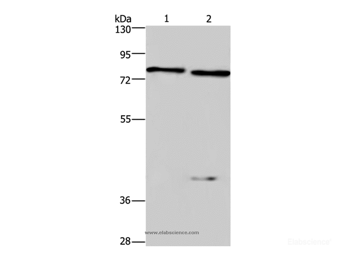 Western Blot analysis of Mouse brain and kindey tissue using COL4A3BP Polyclonal Antibody at dilution of 1:300