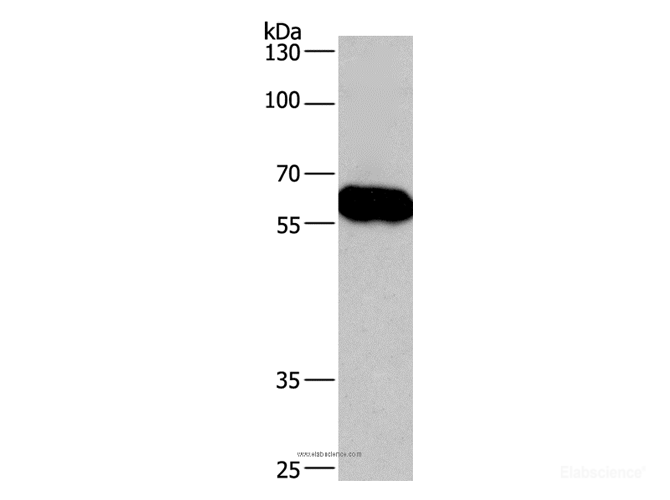 Western Blot analysis of Lovo cell using CORO1C Polyclonal Antibody at dilution of 1:670