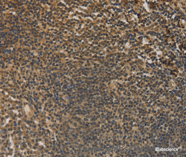 Immunohistochemistry of paraffin-embedded Human tonsil tissue using DACH1 Polyclonal Antibody at dilution 1:50