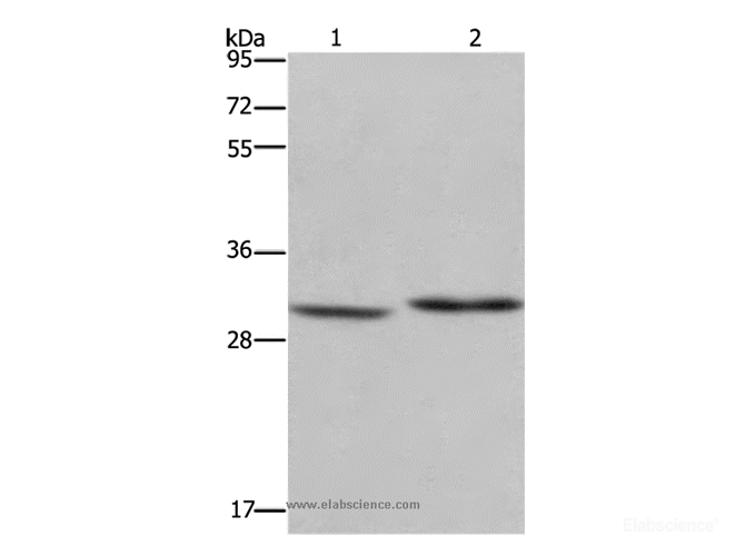 Western Blot analysis of Mouse liver tissue and A375 cell using DHRS3 Polyclonal Antibody at dilution of 1:550