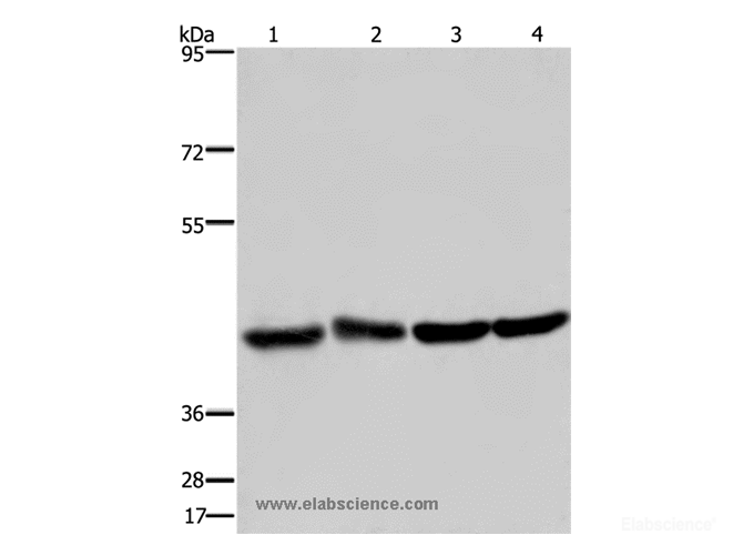 Western Blot analysis of Human fetal liver and brain tissue, 293T and Hela cell using DRG1 Polyclonal Antibody at dilution of 1:350
