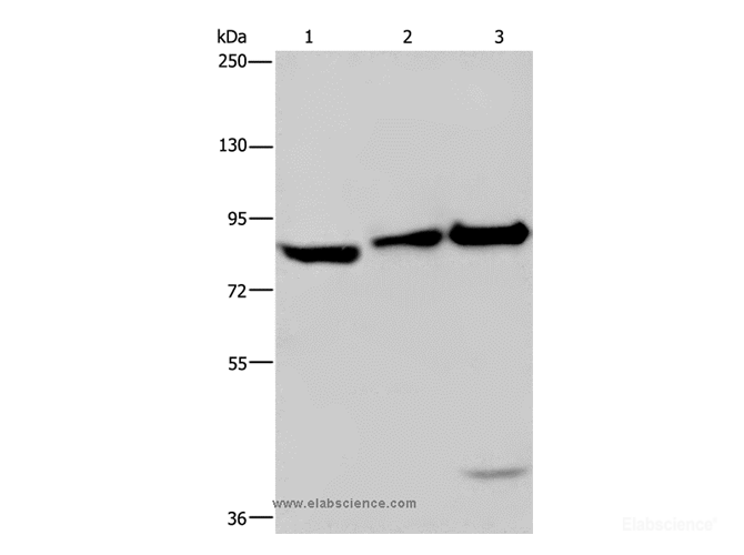 Western Blot analysis of NIH/3T3 cell, Mouse lung and liver tissue using MAPRE3 Polyclonal Antibody at dilution of 1:550