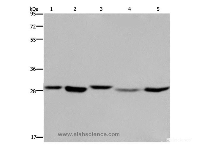 Western Blot analysis of 293T, MCF-7 and PC3 cell, Human fetal liver tissue and Hela cell using ECHS1 Polyclonal Antibody at dilution of 1:300
