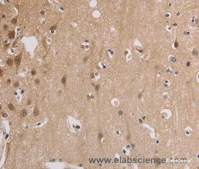 Immunohistochemistry of paraffin-embedded Human brain tissue using ELOVL1 Polyclonal Antibody at dilution 1:30