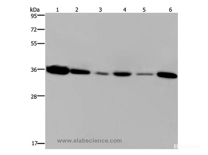 Western Blot analysis of 293T and MCF-7 cell, Human hepatocellular carcinoma tissue and Raji cell, A431 and A549 cell using EMD Polyclonal Antibody at dilution of 1:1200