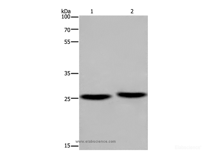 Western Blot analysis of Mouse brain and Human fetal muscle tissue using EPDR1 Polyclonal Antibody at dilution of 1:850