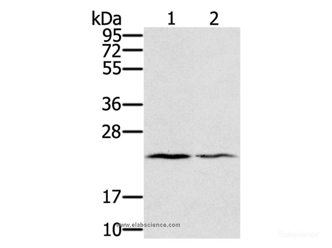 Western Blot analysis of Human normal right lung and normal left lung tissue using EDN2 Polyclonal Antibody at dilution of 1:600