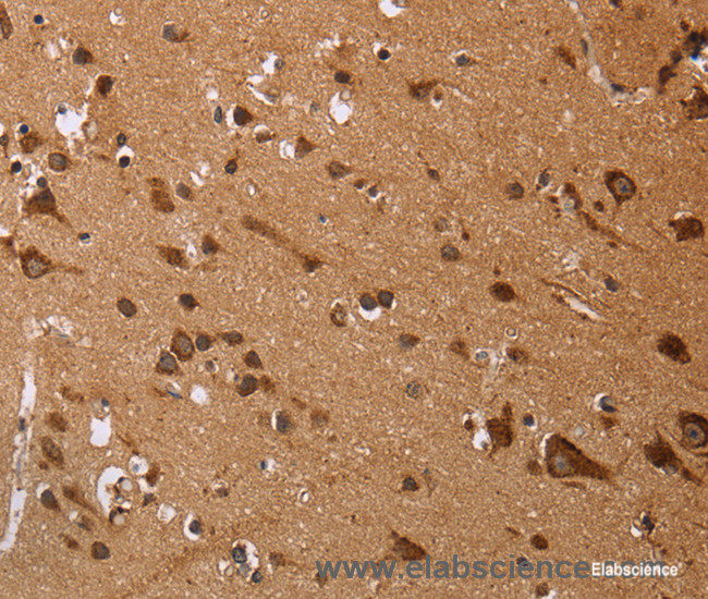 Immunohistochemistry of paraffin-embedded Human brain tissue using EDN3 Polyclonal Antibody at dilution 1:50