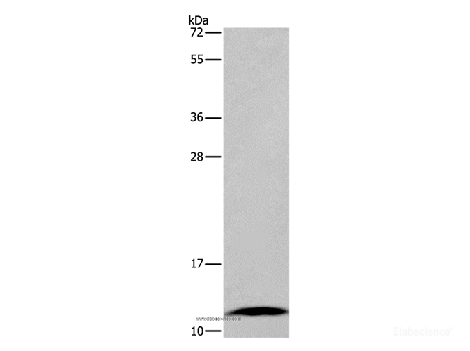 Western Blot analysis of Mouse small intestine tissue using FABP6 Polyclonal Antibody at dilution of 1:550