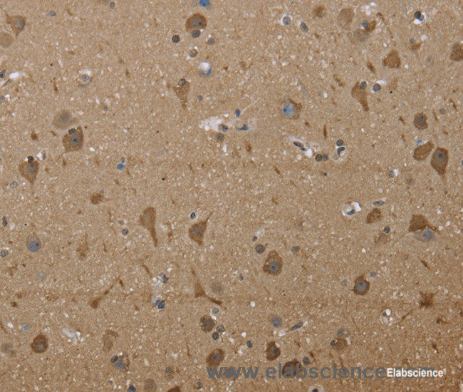 Immunohistochemistry of paraffin-embedded Human brain tissue using PTK2B Polyclonal Antibody at dilution 1:30
