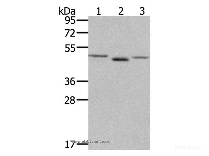 Western Blot analysis of NIH/3T3 cell and Human placenta tissue, lovo cell using FGFRL1 Polyclonal Antibody at dilution of 1:400
