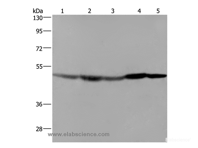Western Blot analysis of Hela cell, Mouse liver, brain and heart tissue, RAW264.7 cell using FH Polyclonal Antibody at dilution of 1:600