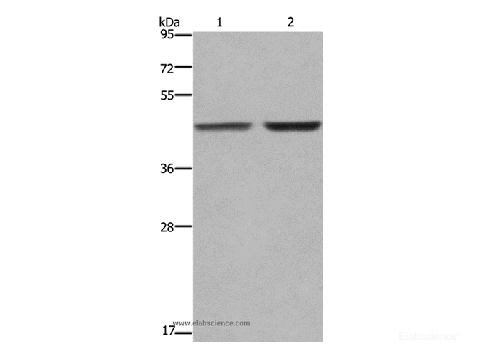 Western Blot analysis of MCF-7 and 231 cell using GABPB2 Polyclonal Antibody at dilution of 1:550