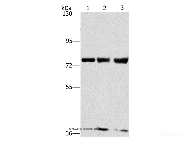 Western Blot analysis of MCF7, hela and 293T cell using GGCX Polyclonal Antibody at dilution of 1:400