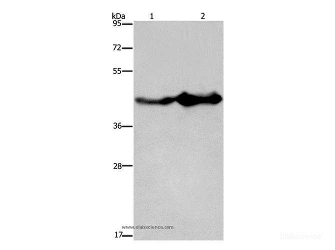 Western Blot analysis of Mouse liver and brain tissue using GLUL Polyclonal Antibody at dilution of 1:600