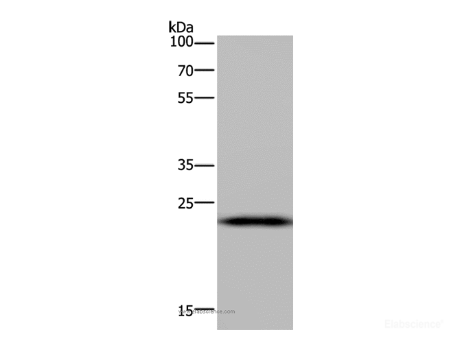 Western Blot analysis of Mouse liver tissue using PAEP Polyclonal Antibody at dilution of 1:300
