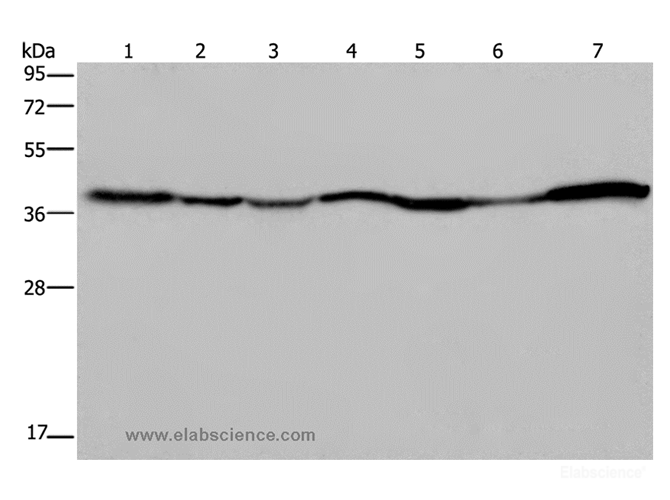 Western Blot analysis of 293T and Hela cell, Human fetal liver, Mouse spleen and heart tissue, Human fetal brain and hepatocellular carcinoma tissue using GOT2 Polyclonal Antibody at dilution of 1:400