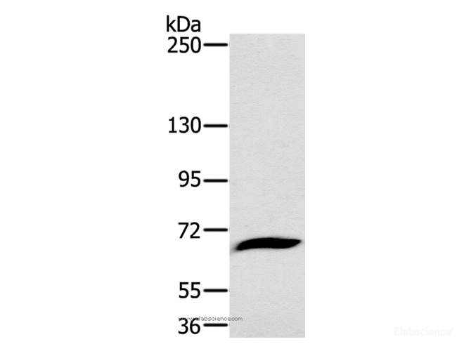 Western Blot analysis of Mouse liver tissue using CD42b Polyclonal Antibody at dilution of 1:800