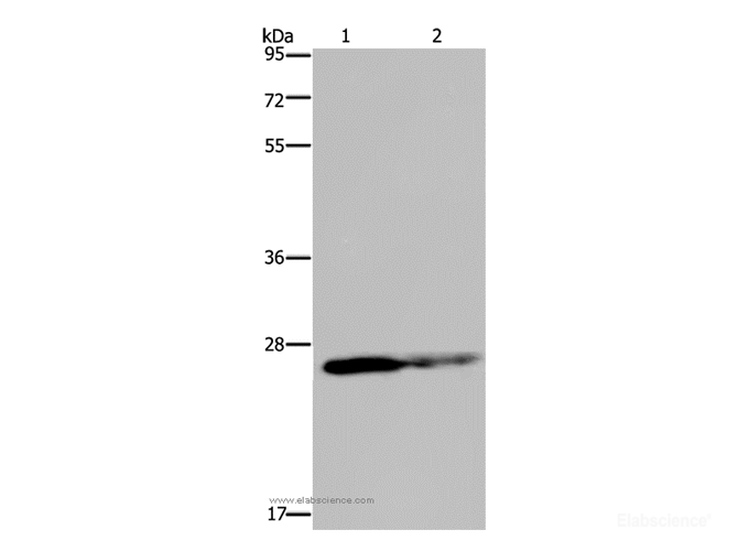 Western Blot analysis of HT-29 cell and Human fetal brain tissue using GSTP1 Polyclonal Antibody at dilution of 1:350