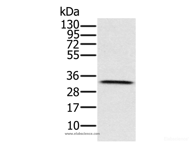 Western Blot analysis of Human testis tissue using HSD17B8 Polyclonal Antibody at dilution of 1:650
