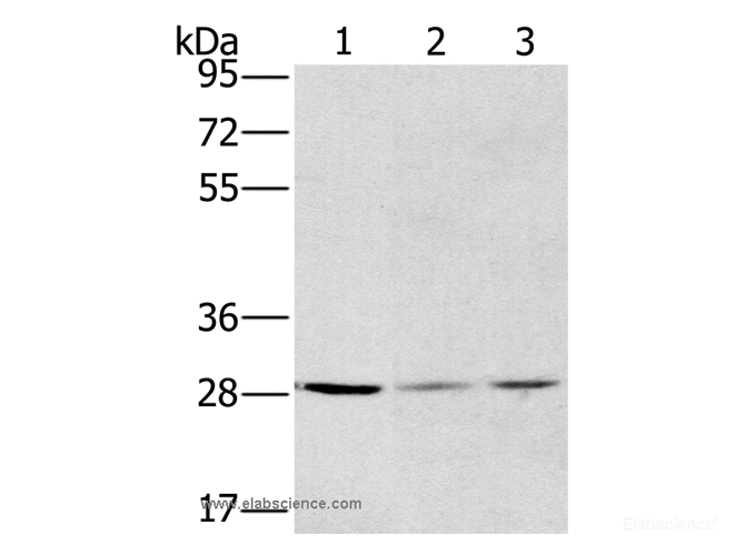Western Blot analysis of A375, hela and A172 cell using HSD17B12 Polyclonal Antibody at dilution of 1:570