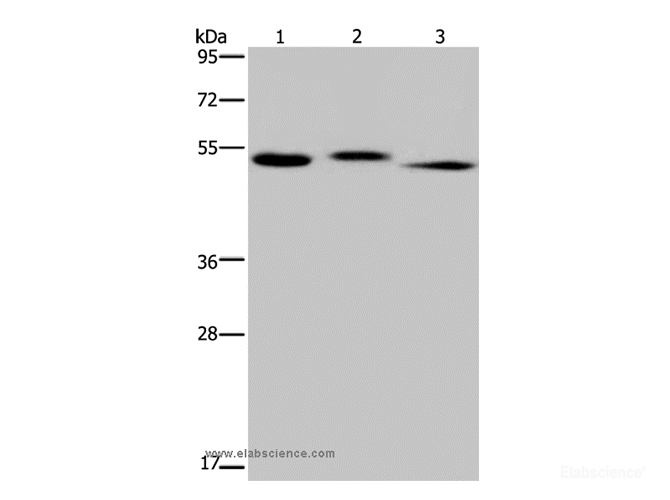Western Blot analysis of Human kidney tissue, HepG2 cell and Human testis tissue using HYAL3 Polyclonal Antibody at dilution of 1:400