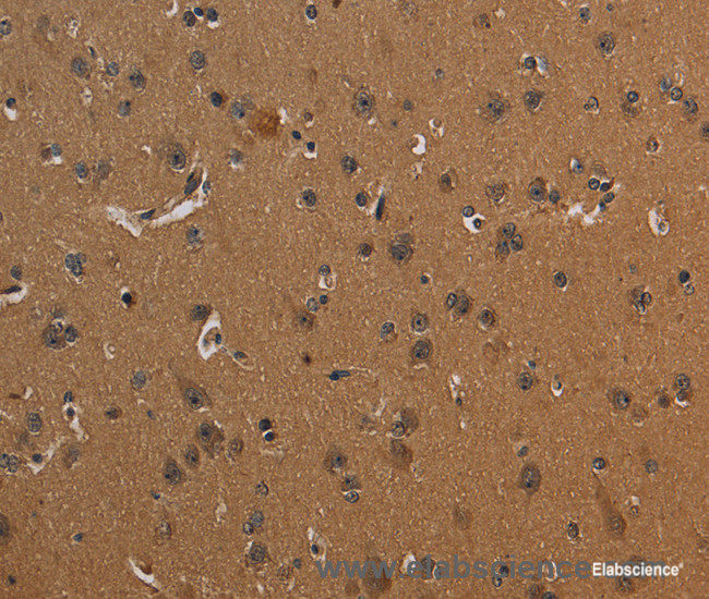 Immunohistochemistry of paraffin-embedded Human brain tissue using CD242 Polyclonal Antibody at dilution 1:30