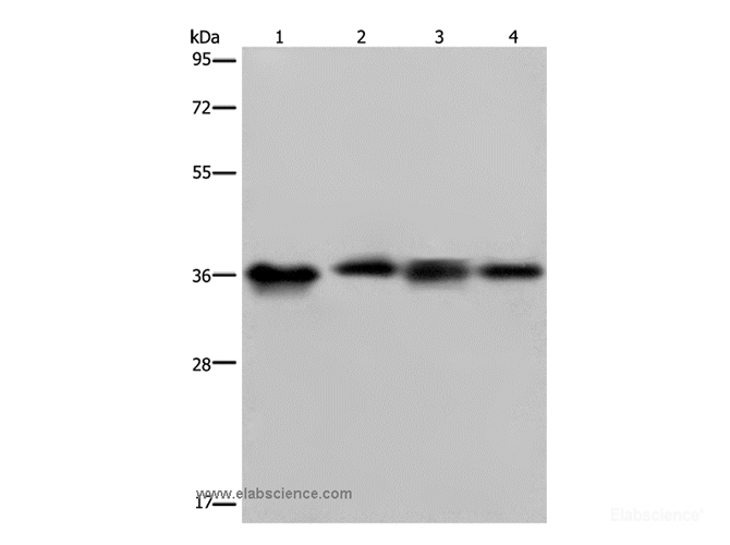 Western Blot analysis of HepG2 and 293T cell, Human kidney cancer tissue and K562 cell using JAM-A Polyclonal Antibody at dilution of 1:500