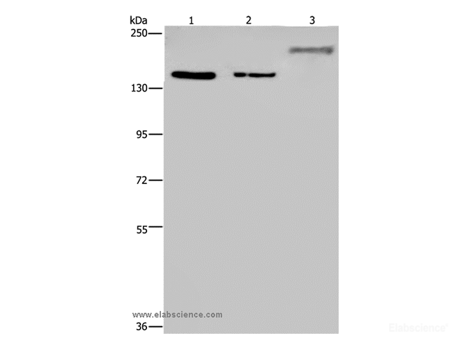 Western Blot analysis of Hela and 293T cell, Mouse skeletal muscle tissue using KDM3B Polyclonal Antibody at dilution of 1:1000