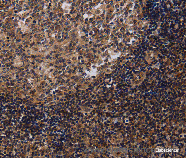 Immunohistochemistry of paraffin-embedded Human tonsil tissue using NTMT1 Polyclonal Antibody at dilution 1:40