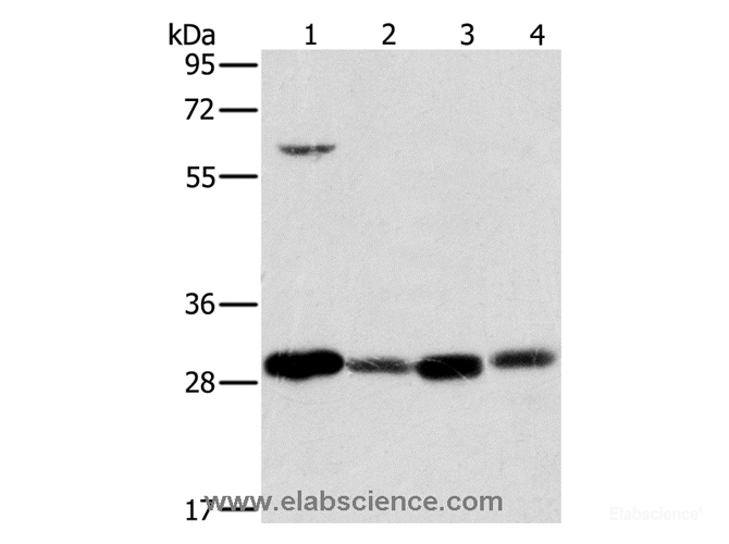 Western Blot analysis of 293T cell and Human testis tissue, A375 cell and Human normal kidney tissue using MRPL28 Polyclonal Antibody at dilution of 1:600