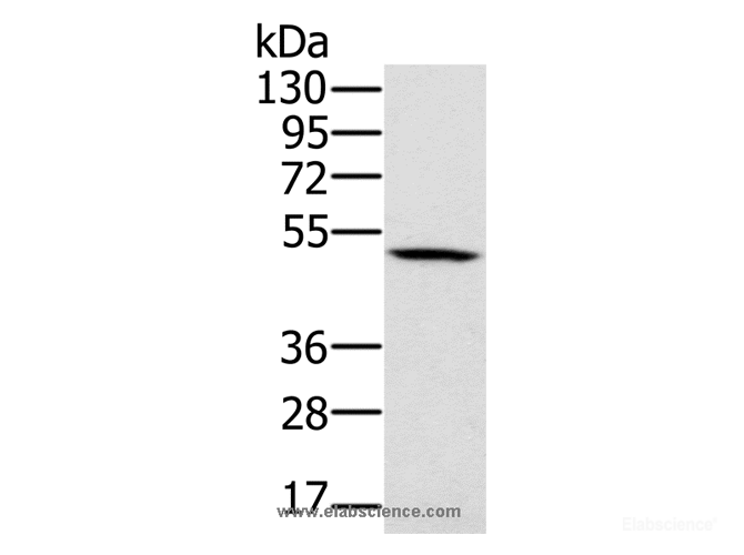 Western Blot analysis of 231 cell using PSMC2 Polyclonal Antibody at dilution of 1:500