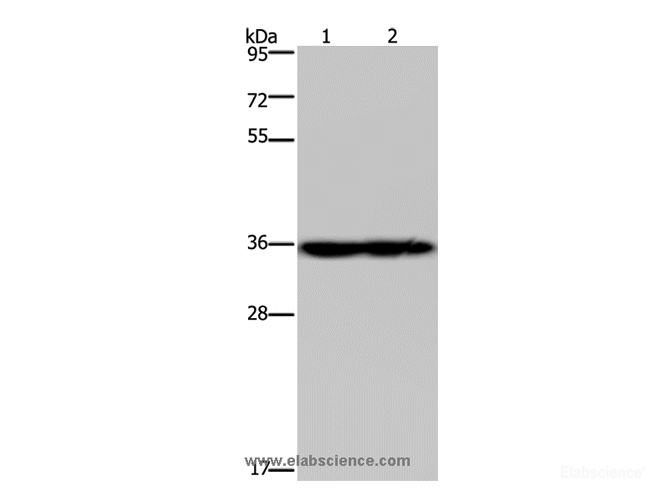 Western Blot analysis of Mouse heart and kidney tissue using NDUFA9 Polyclonal Antibody at dilution of 1:400