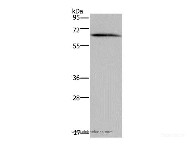 Western Blot analysis of Human brain malignant glioma tissue using NCF2 Polyclonal Antibody at dilution of 1:200