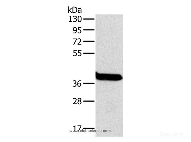 Western Blot analysis of Mouse liver tissue using OTC Polyclonal Antibody at dilution of 1:800