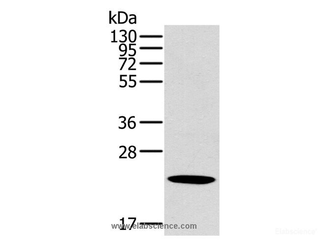 Western Blot analysis of Human liver cancer tissue using OTUB2 Polyclonal Antibody at dilution of 1:800