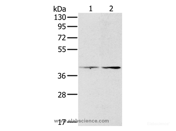 Western Blot analysis of Hela and lovo cell using PDGFRL Polyclonal Antibody at dilution of 1:400