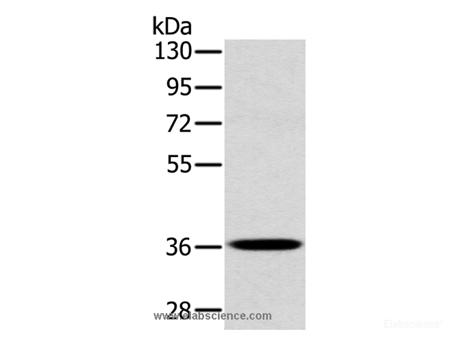 Western Blot analysis of A172 cell using CLP36 Polyclonal Antibody at dilution of 1:400