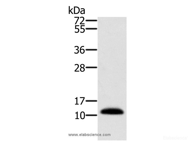 Western Blot analysis of Human prostate tissue using MSMB Polyclonal Antibody at dilution of 1:250