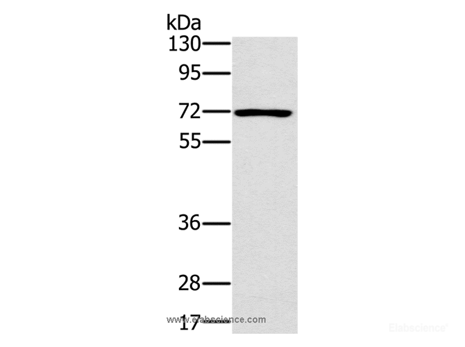 Western Blot analysis of Raji cell using PLS3 Polyclonal Antibody at dilution of 1:400