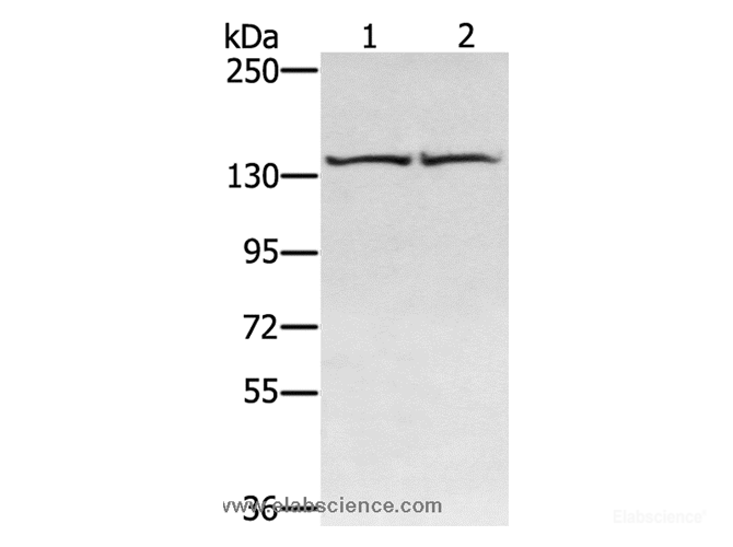 Western Blot analysis of Hela and hepg2 cell using RGS22 Polyclonal Antibody at dilution of 1:400