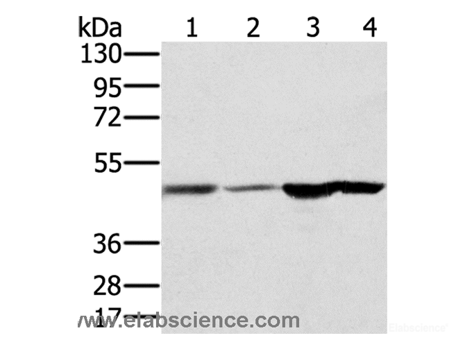 Western Blot analysis of Human fetal brain and normal liver tissue, Human normal kidney tissue and hepg2 cell using RNH1 Polyclonal Antibody at dilution of 1:400