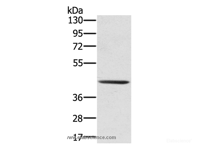 Western Blot analysis of 231 cell using SCPEP1 Polyclonal Antibody at dilution of 1:300
