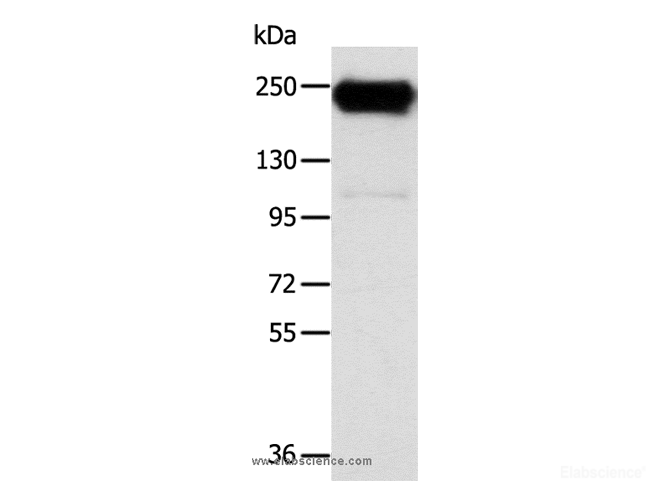 Western Blot analysis of K562 cell using RRBP1 Polyclonal Antibody at dilution of 1:400