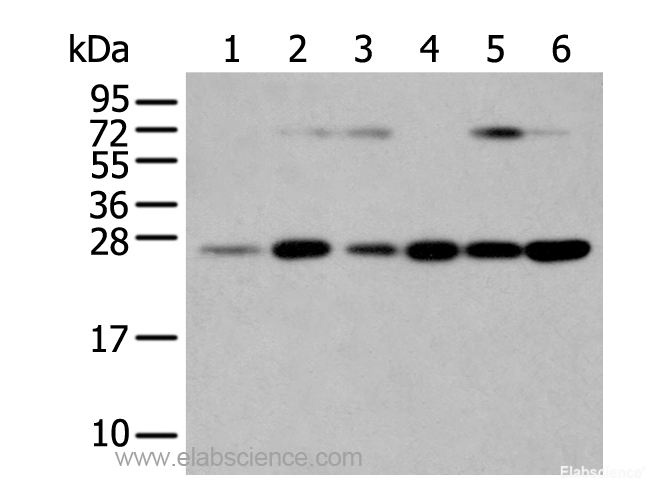 Western Blot analysis of Human placenta tissue and hela cell, hepg2 cell and Human fetal liver tissue, A549 cell and Human normal kidney tissue using SNAP23 Polyclonal Antibody at dilution of 1:400