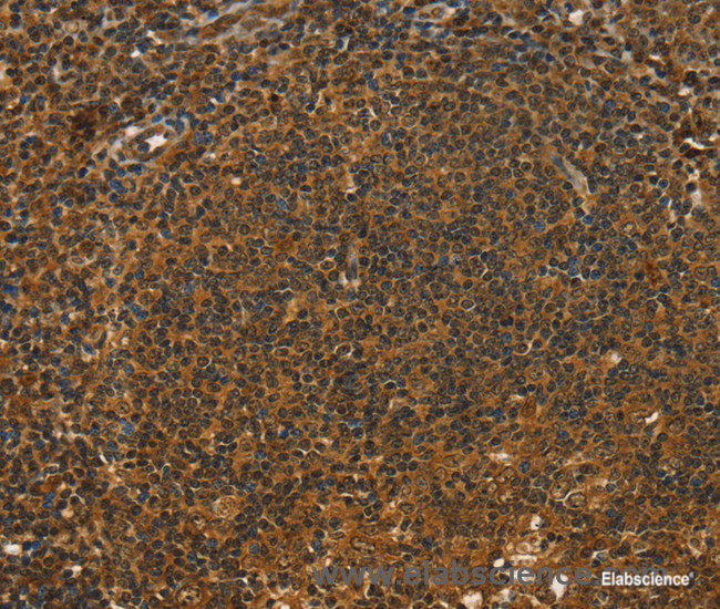 Immunohistochemistry of paraffin-embedded Human tonsil tissue using STAR Polyclonal Antibody at dilution 1:40