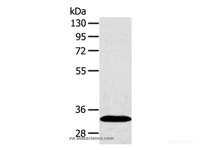 Western Blot analysis of Human fetal liver tissue using SULT2A1 Polyclonal Antibody at dilution of 1:650